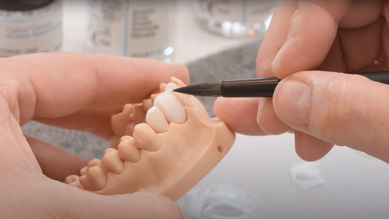 res-image-thumbnail-cerec-tessera-cut-back.png