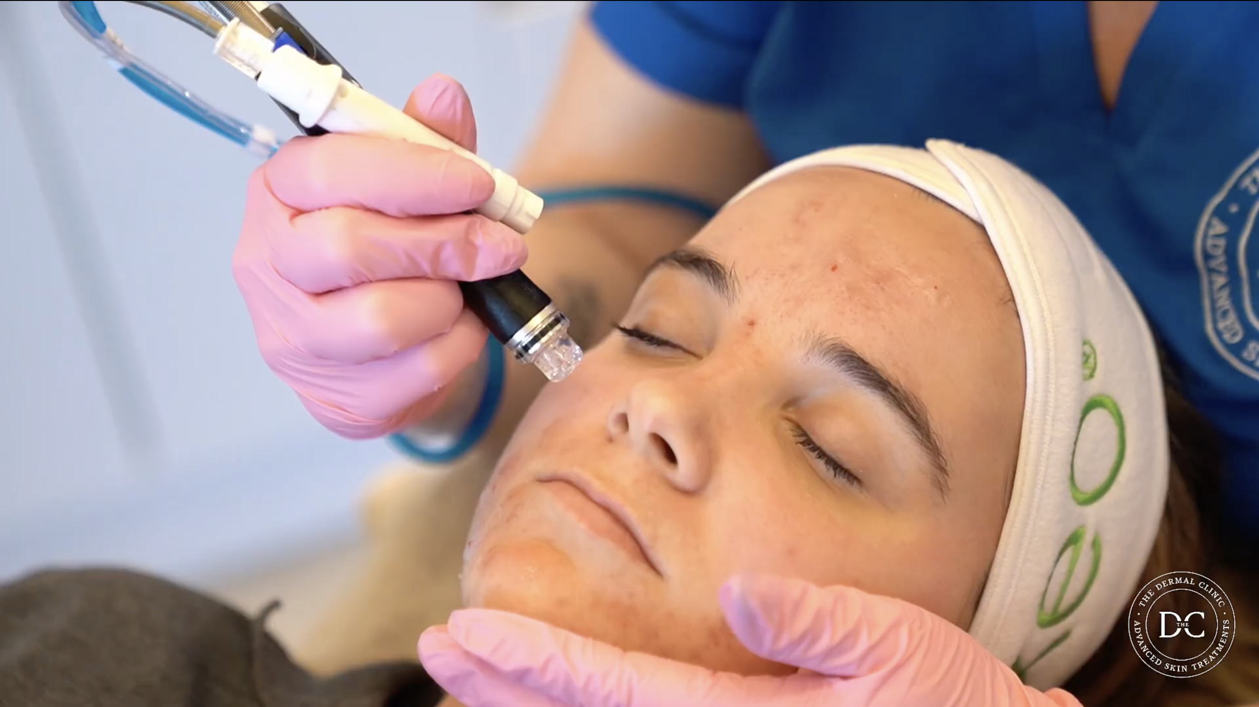 Hydrafacial | The Dermal Clinic