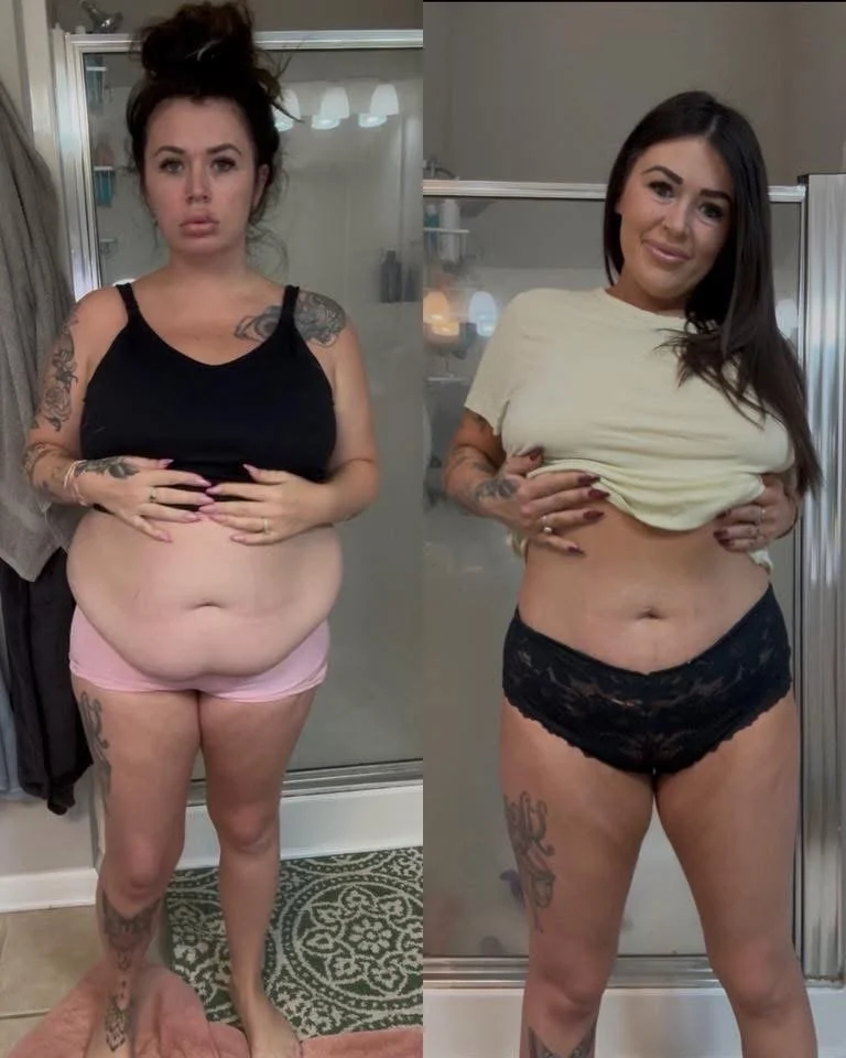 Side-by-side comparison of a woman before and after weight loss. In the left image, she is wearing a black tank top and pink shorts, appearing heavier with visible stomach and thighs. In the right image, she is wearing a light-colored T-shirt and black lace shorts, looking slimmer with a toned stomach and more defined legs.