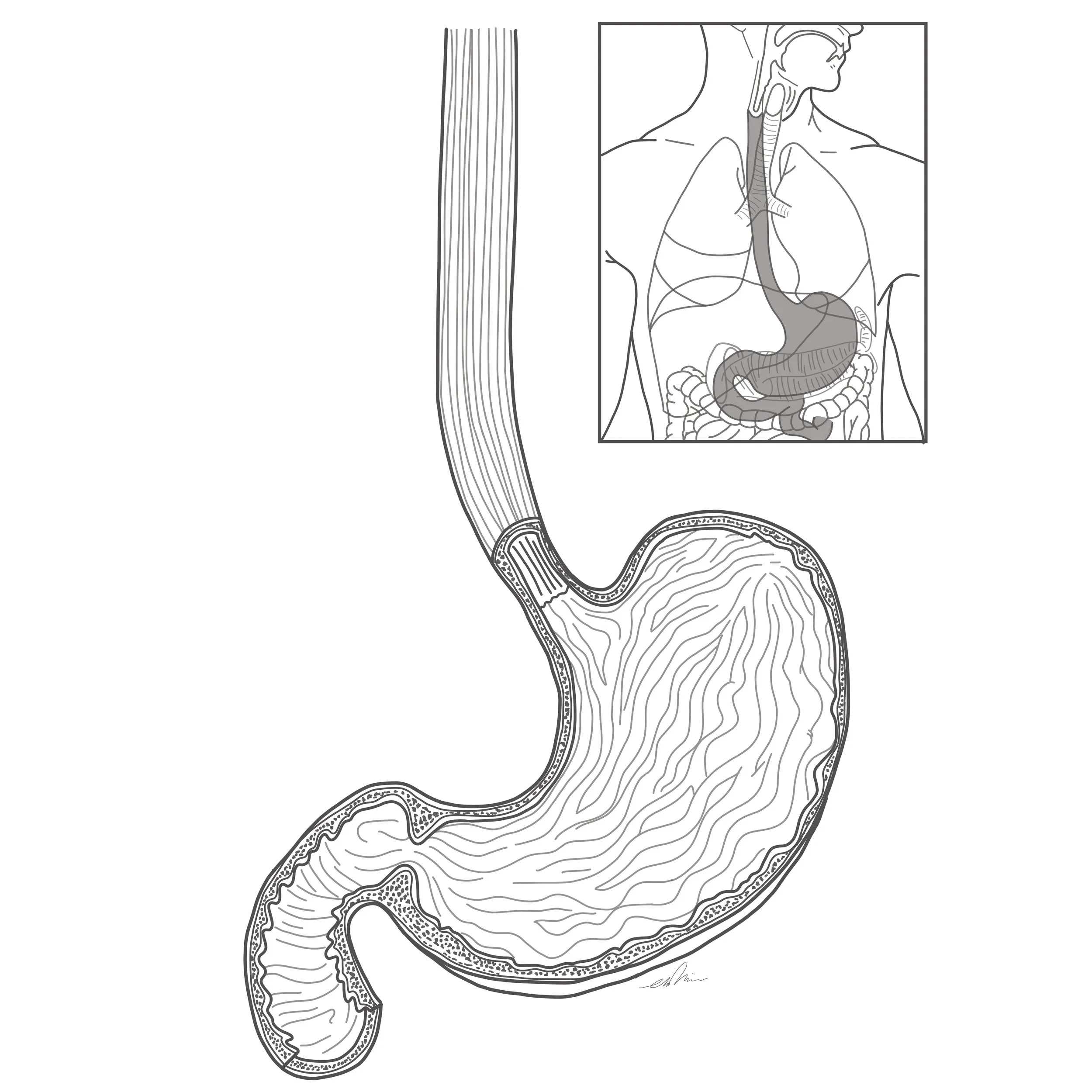 stomach.jpg