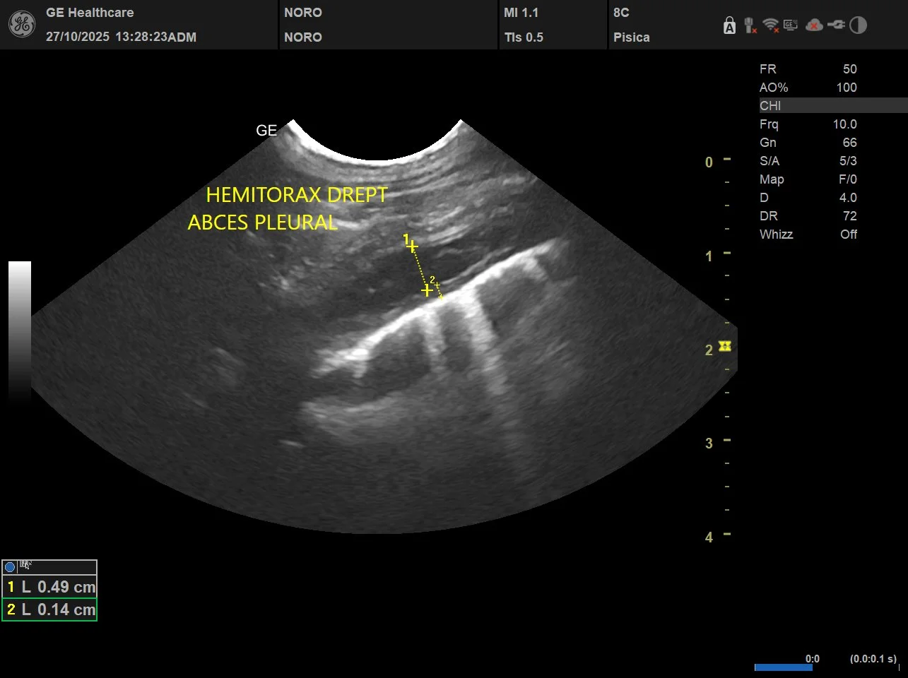 Când este recomandată ecografia toracică pentru câini și pisici