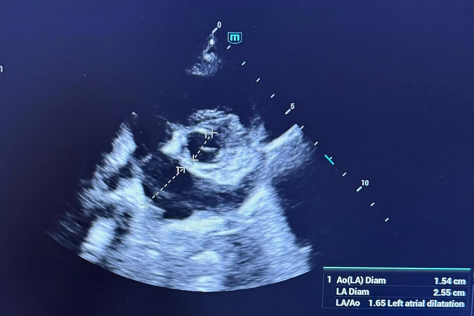 Ce cauzează insuficiența cardiacă la câini și cum o gestionează echipa SpeedVet?