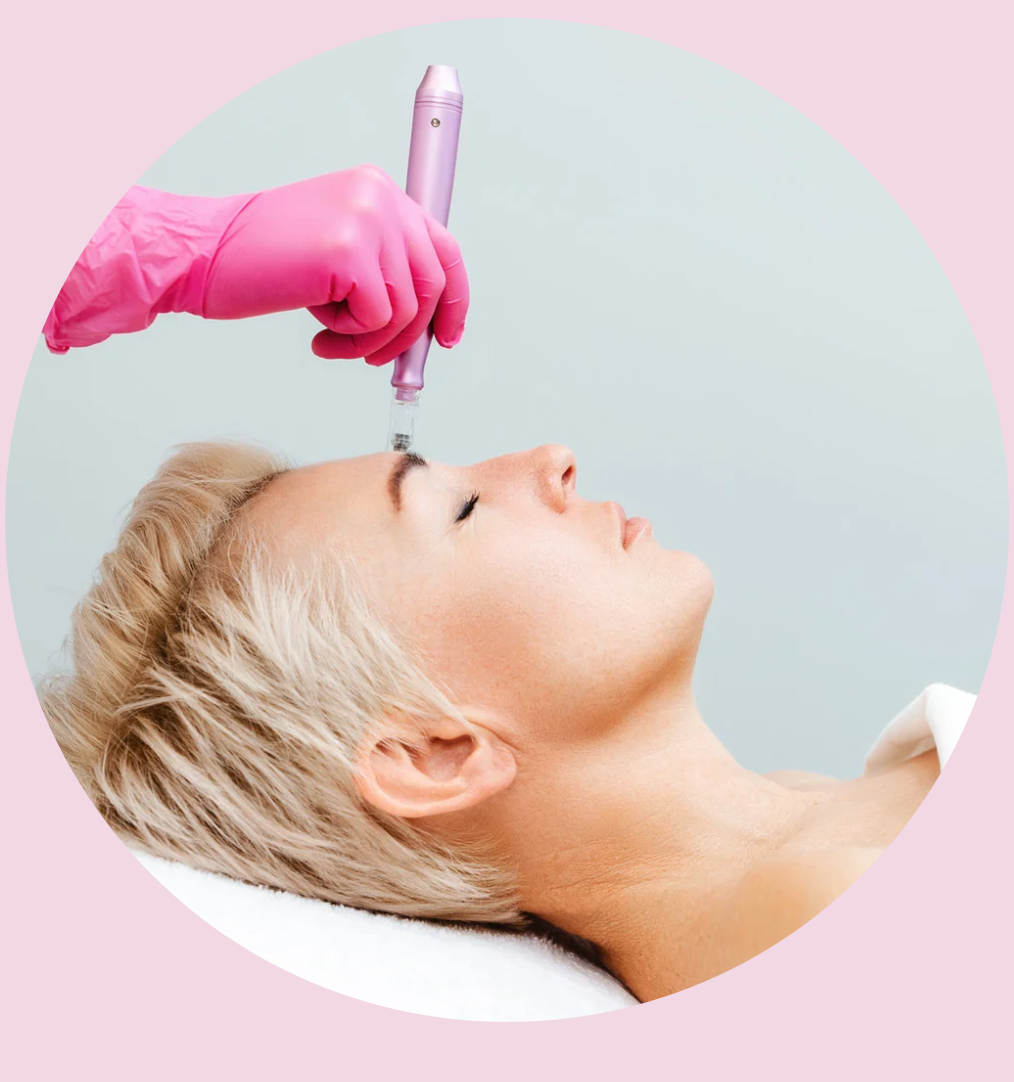 Does Microneedling Hurt? Here's What You Can Really Expect ✨