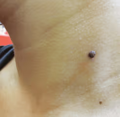 Close-up of a person's light skin with a small, dark belly button piercing and a mole nearby.