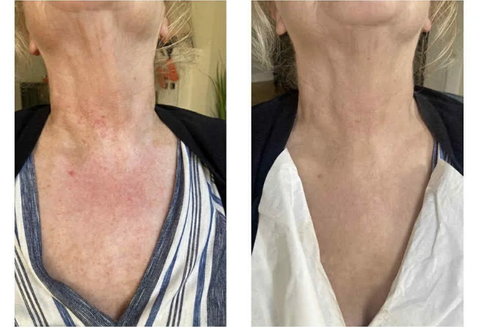 Neck.jpg