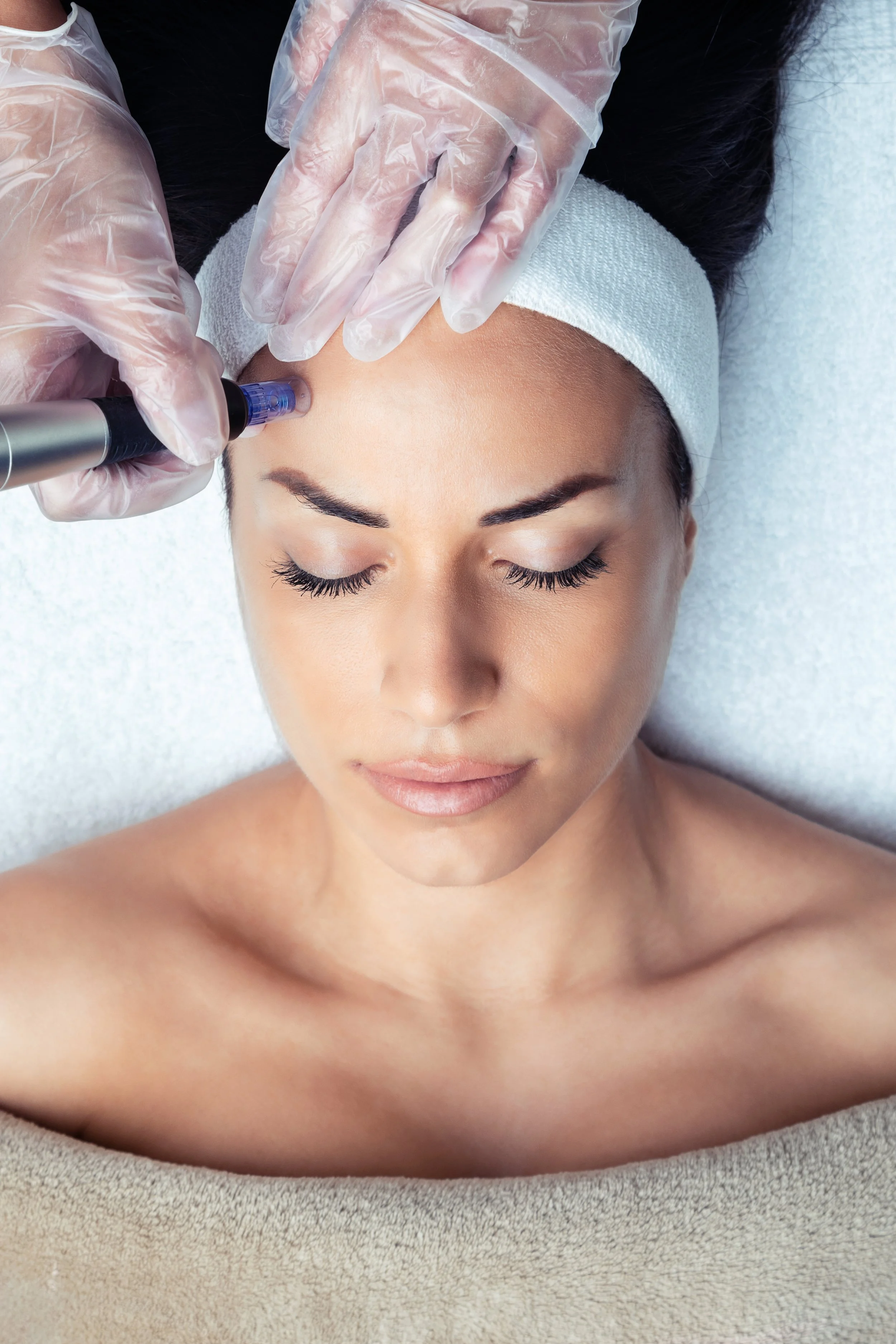 Woman receiving facial microneedling treatment, wearing a headband, with technician's gloved hands applying the device.