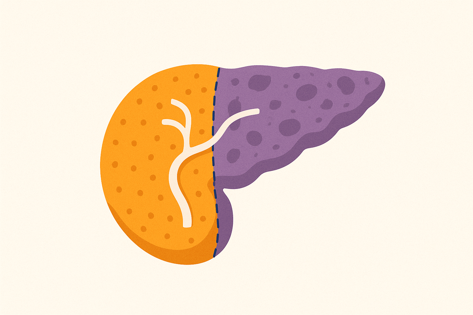 Diagram of a human pancreas, showing the divided sections with different textures and colors.