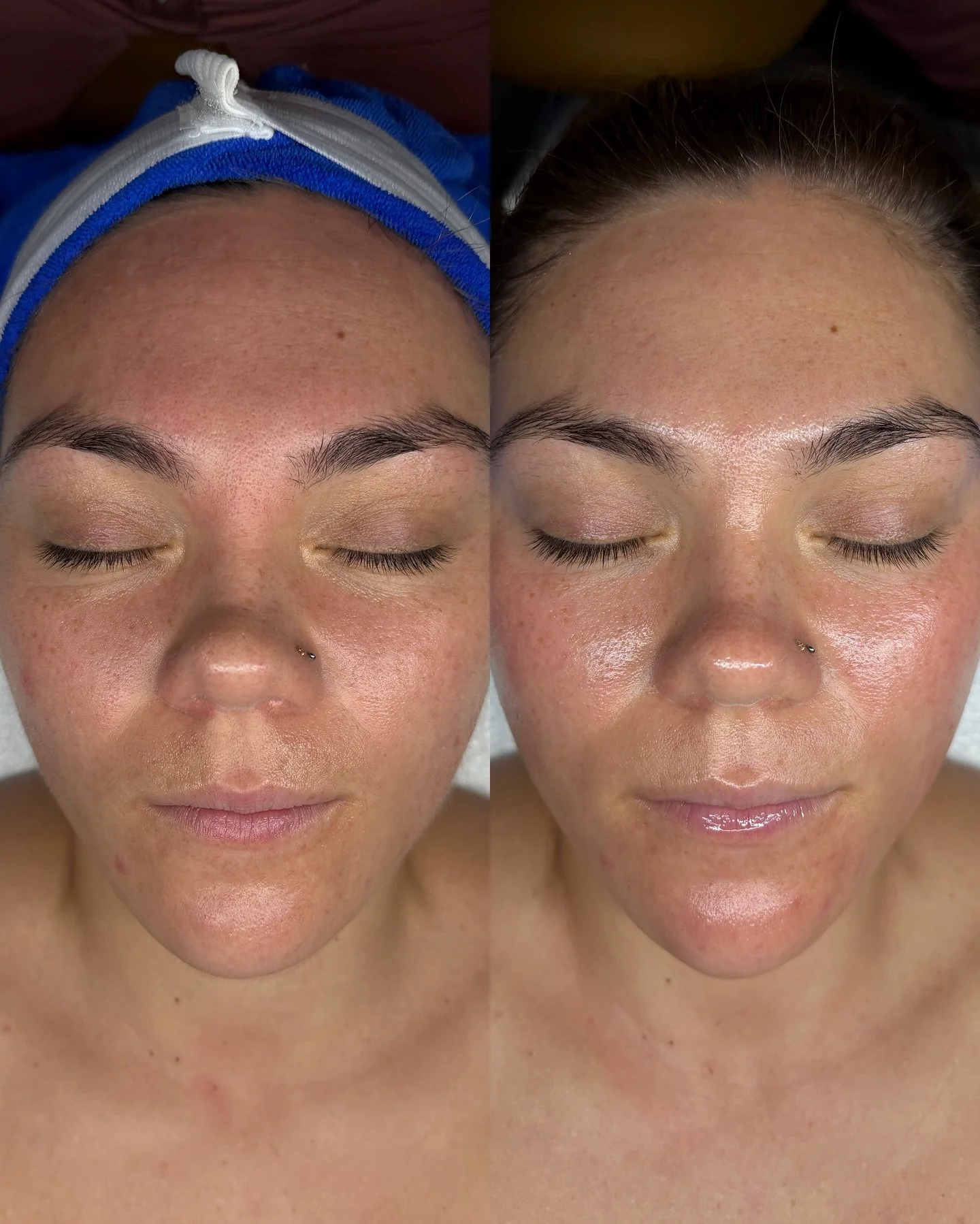 She&rsquo;s got style, she&rsquo;s got grace, she&rsquo;s a glo2facial babe 💜🫧✨