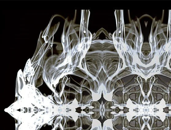 Idolomantiz Gold EtherZ.jpg