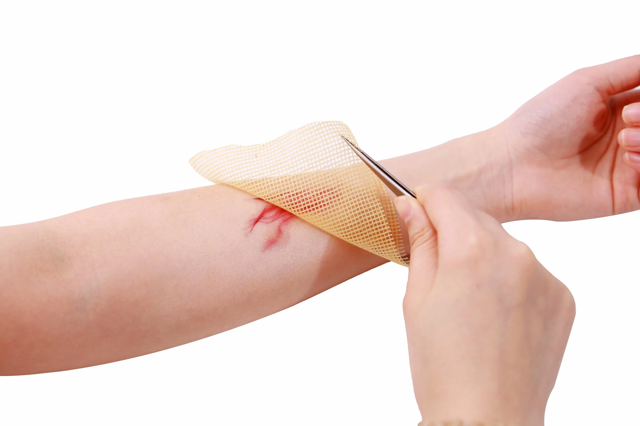 Person removing a bandage from a healing wound on their forearm