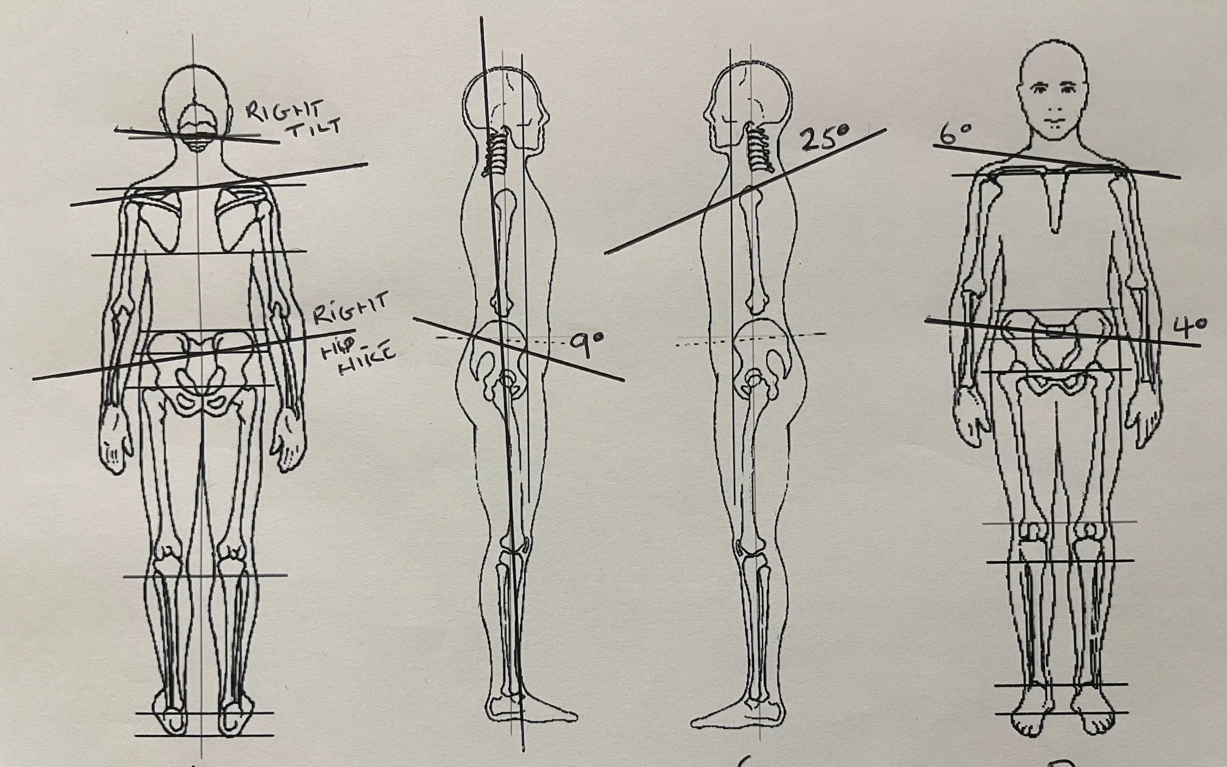 Posture assessment sheet highlighting muscle imbalances as part of personalised training evaluation