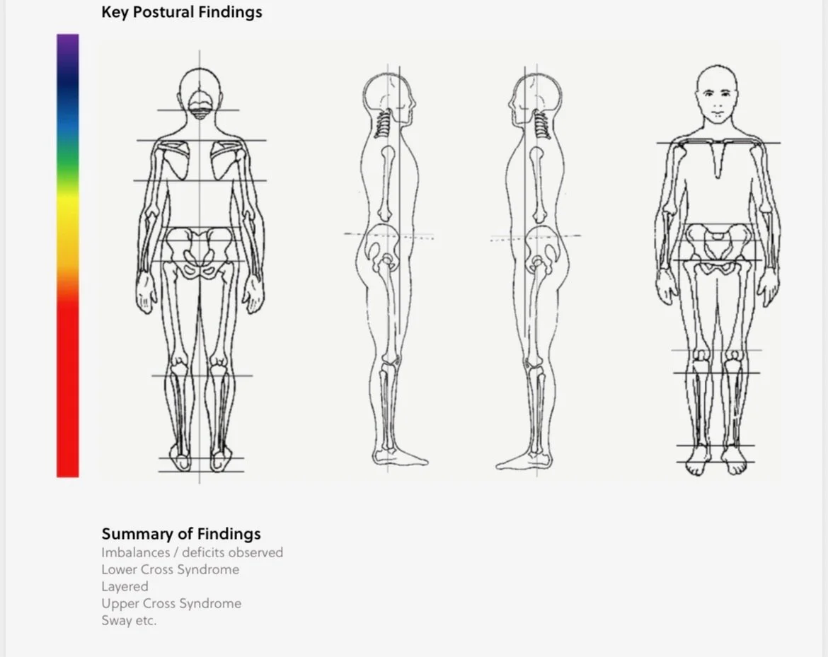 Printed posture consultation form featuring skeletal diagrams used to mark movement imbalances and alignment issues.