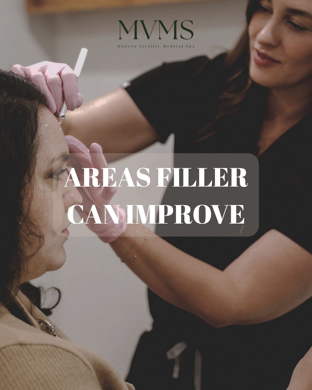 Filler isn&rsquo;t just for lips! 💉
The real goal? Facial balance, structure, and harmony. Here&rsquo;s how we use it:

✨ Cheeks &ndash; restores volume, lifts, and supports mid face
✨ Jawline &ndash; defines the lower face &amp; improves profile
✨ 