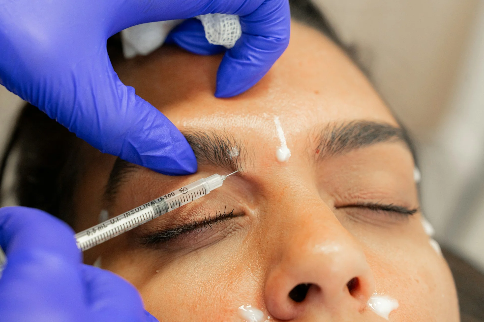 How a Brow Lift With Botox Can Refresh Tired-Looking Eyes