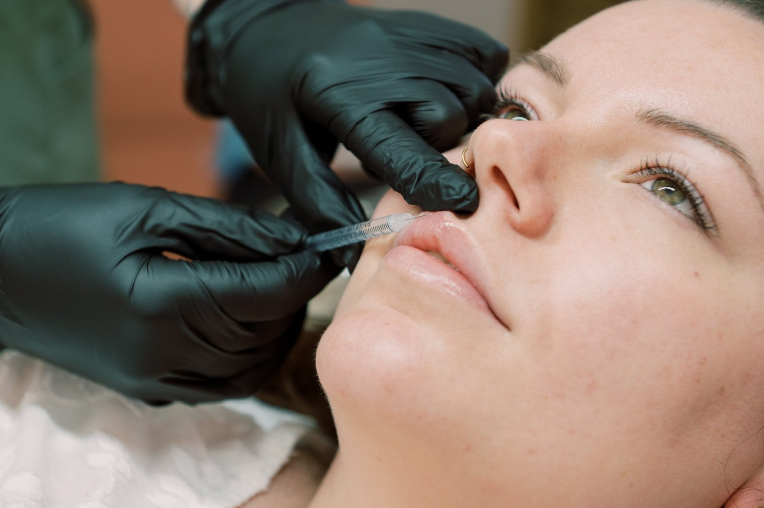 Kia carrying out a bespoke dermal filler treatment at Straday Studio in Fareham