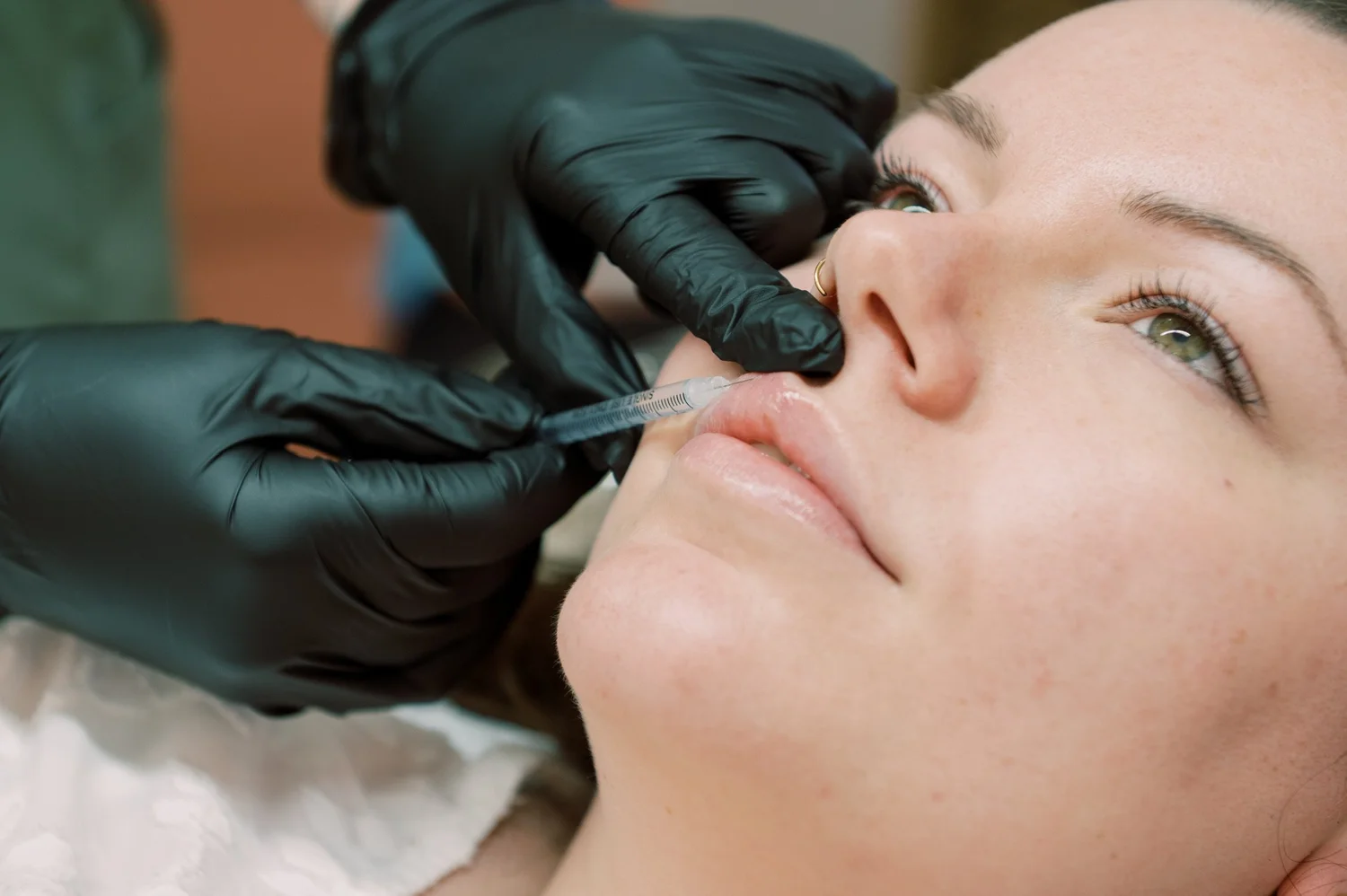 Kia carrying out an aesthetics treatment at Straday Studio in Fareham