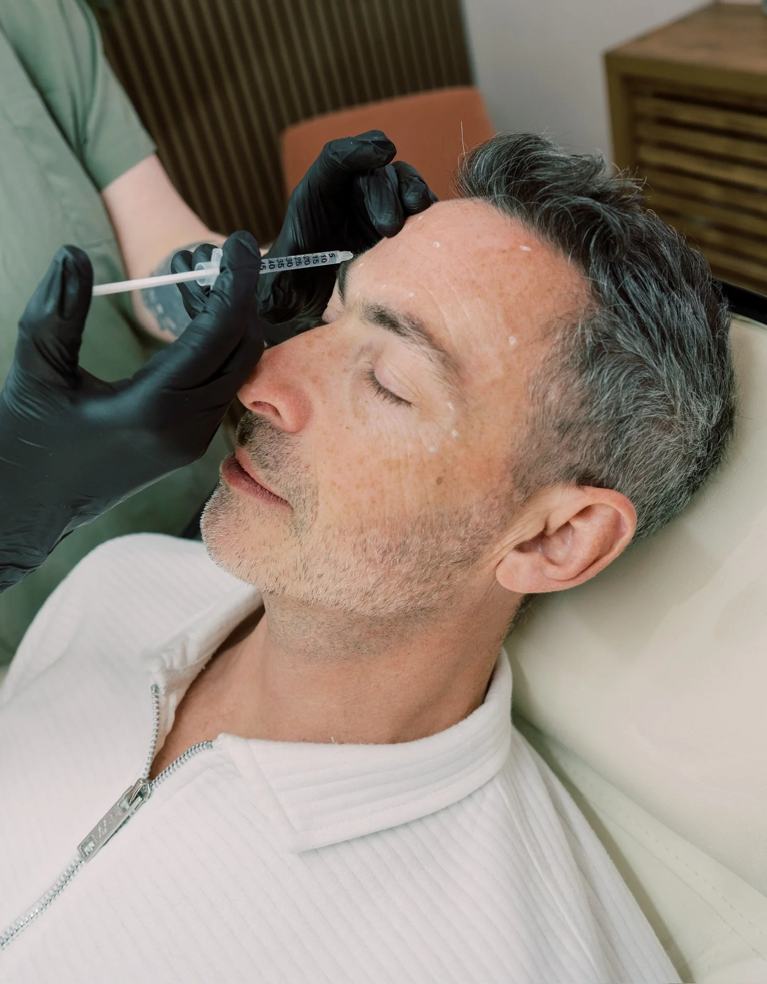 Dermal filler treatment at Straday Studio in Fareham