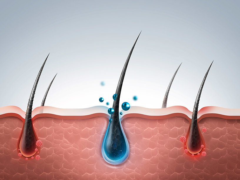hairfollicles.jpg