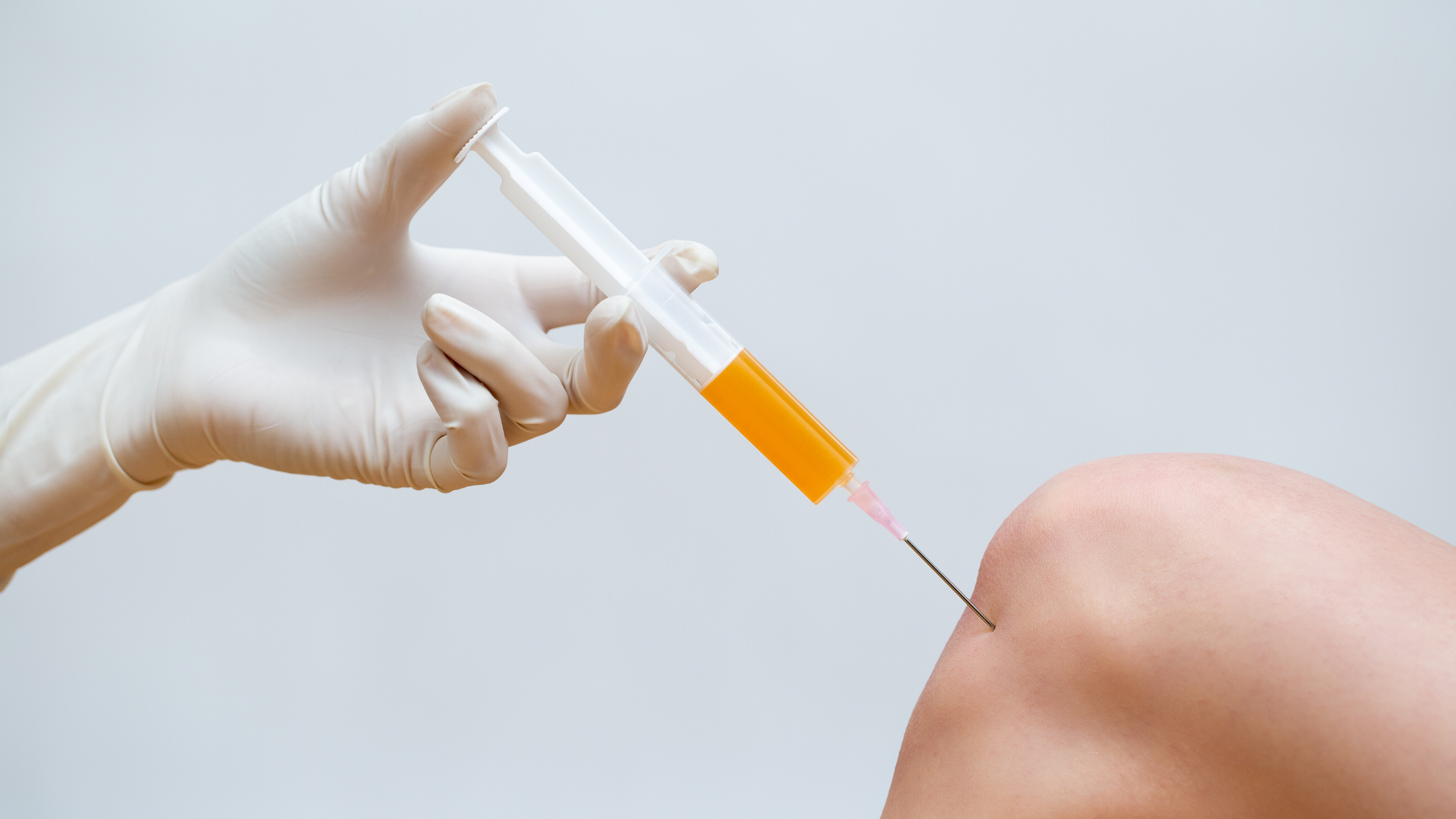 Does PRP Really Work for Knee Arthritis?