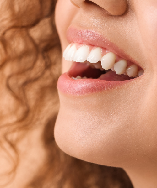 6‑Monthly Dental Visits: Your Glow‑Up Ritual at Smile Haus