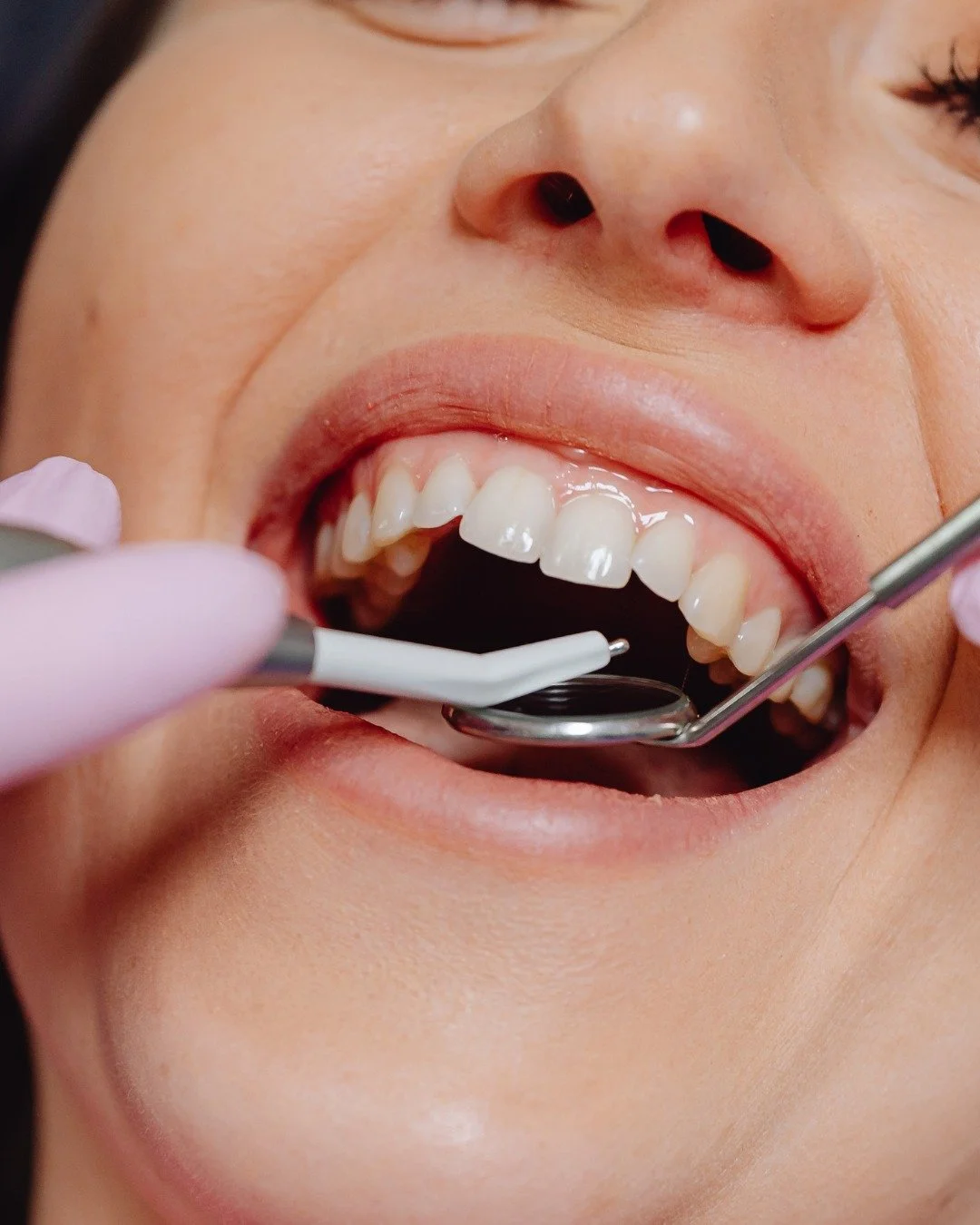 Fun fact: Smiling more can actually boost your mood! 😄 

Why not make your smile something you&rsquo;re proud to show off? At Smile Haus, we combine premium care with personalised treatments to make sure your smile radiates confidence &mdash; inside