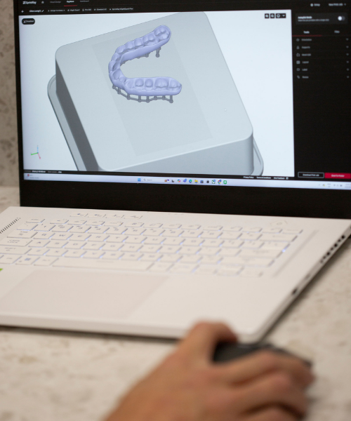 3D printing smile haus perth dental clinic Shenton Park dentist.png