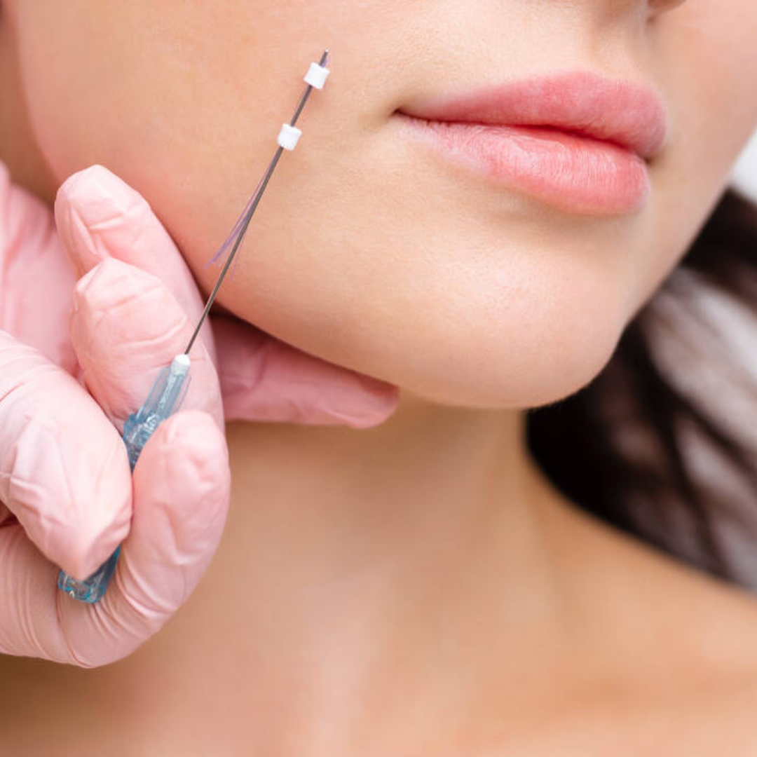Dre's Medspa-PDO Thread.png