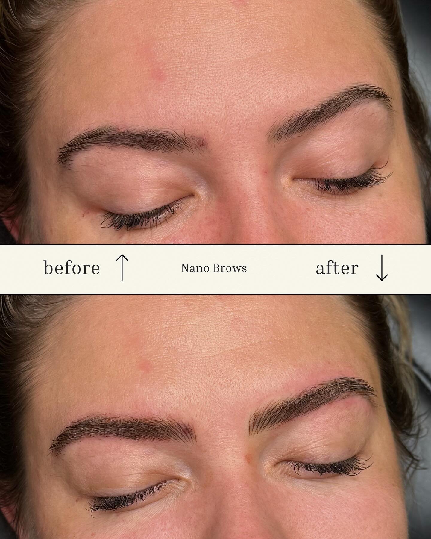 ✨ Nano Brow Cover-Up ✨
Say goodbye to old microblading that has faded unevenly or left behind shape + color you&rsquo;re no longer happy with. Nano brows are the perfect solution for refreshing your look &mdash; using ultra-fine, hair-like strokes an