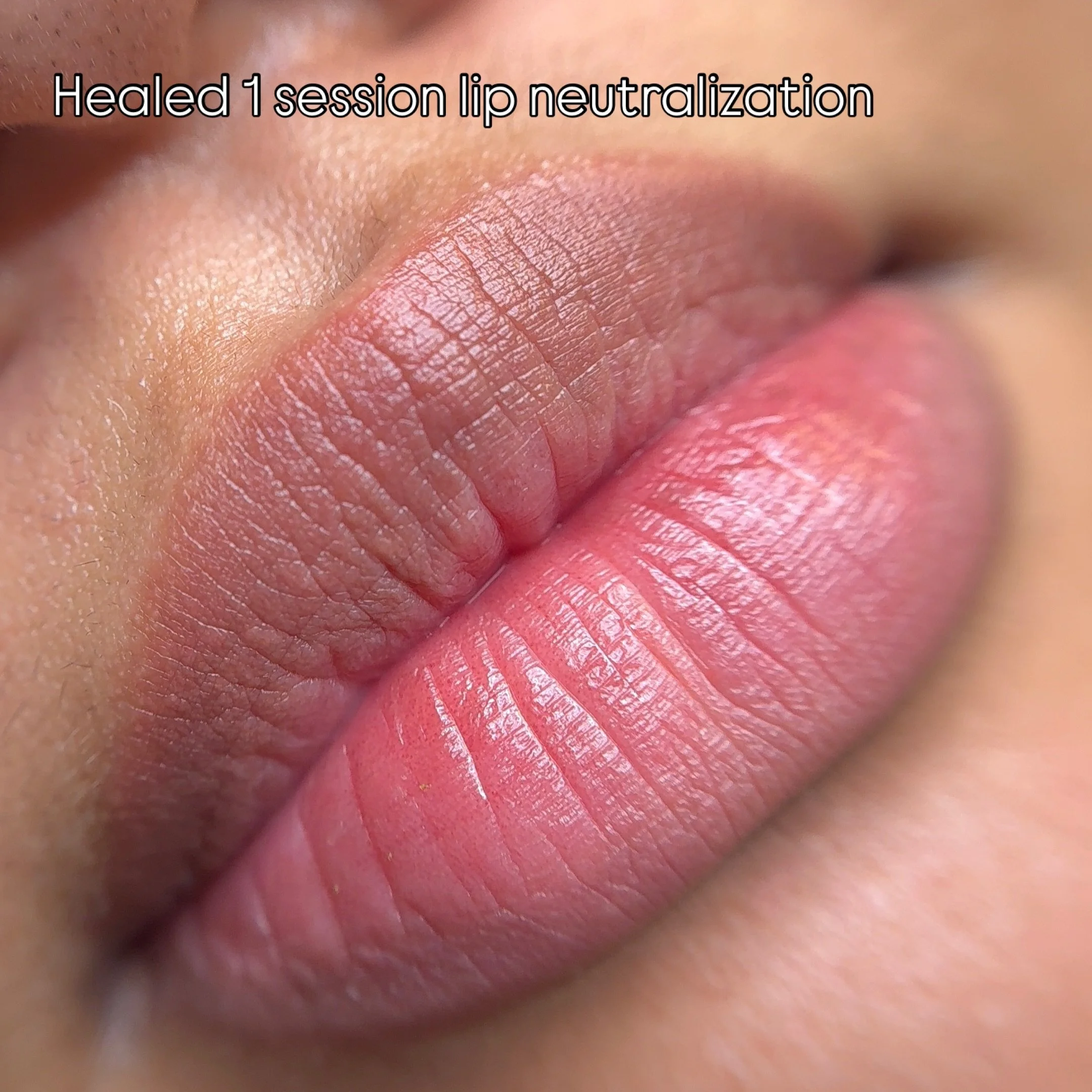 A realistic result when it comes to lip neutralization and lip brightening 

This is only one session and we have already done the touch up so I can&rsquo;t wait to see the results 

If interested please DM to further discuss 

#lipblushbrightening #