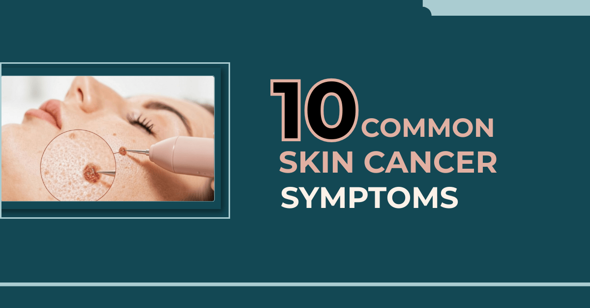 10 Common Skin Cancer Symptoms on Face and Body