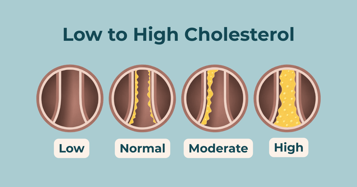 Low to High Cholesterol