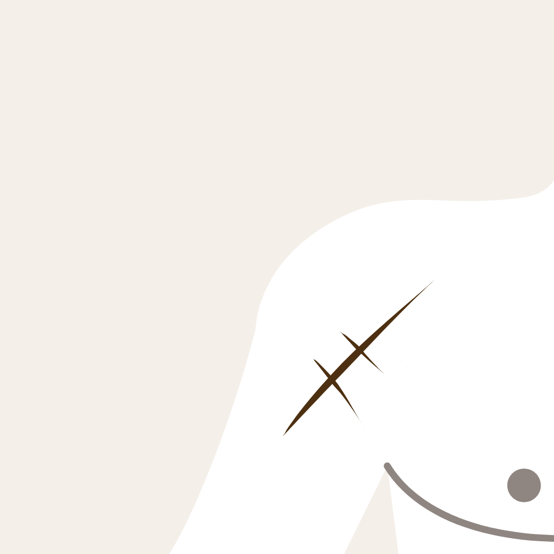 Scar Camouflage Results