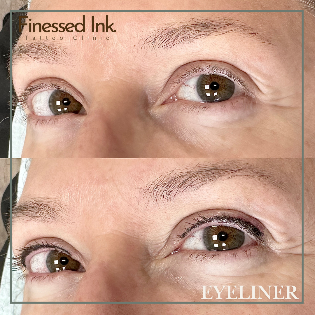Lash Line Enhancement