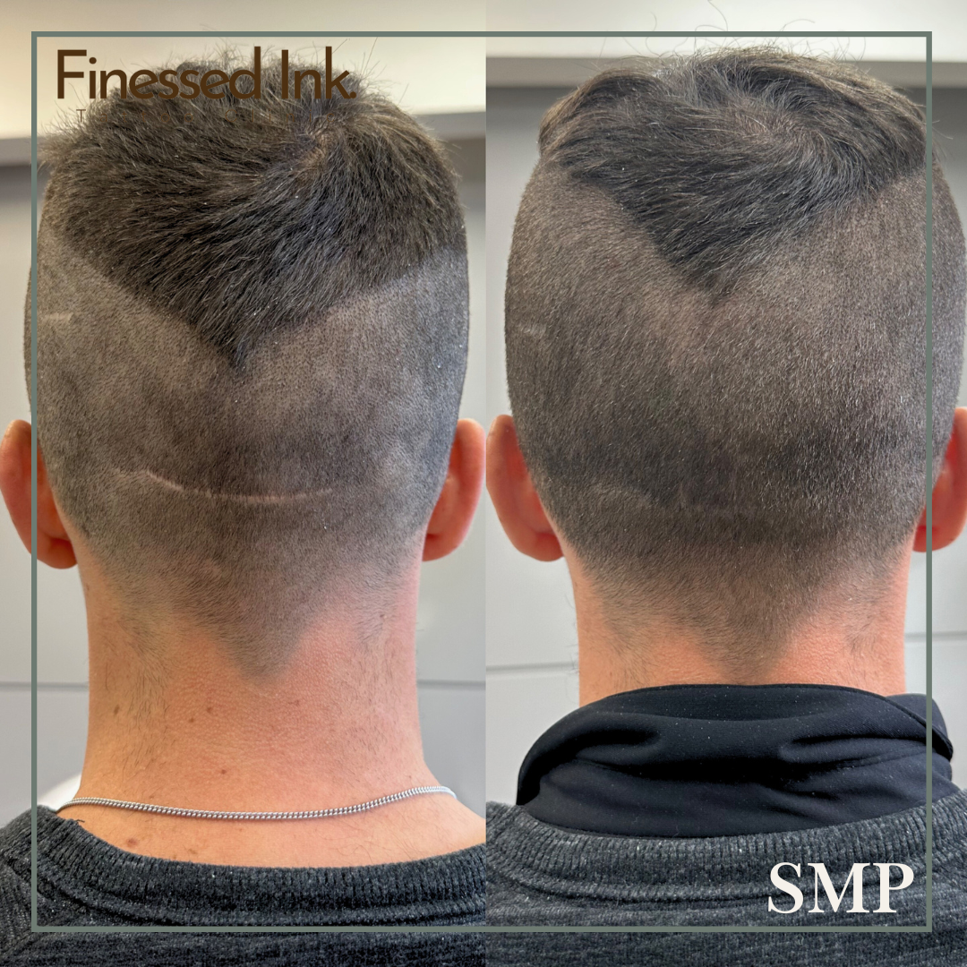 Side-by-side comparison of a man's haircut showing before and after styling, with close-cut sides and a textured top, labeled 'Finessed Ink' and 'SMP'.