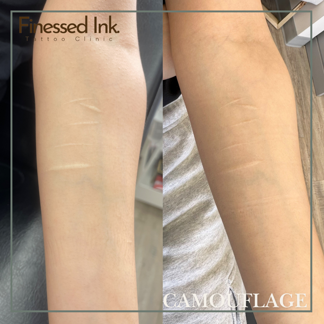 Scar Camouflage tattoo.png
