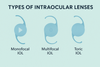 Best IOL for Cataract Surgery Sydney | Patient’s Guide — The Cataract ...