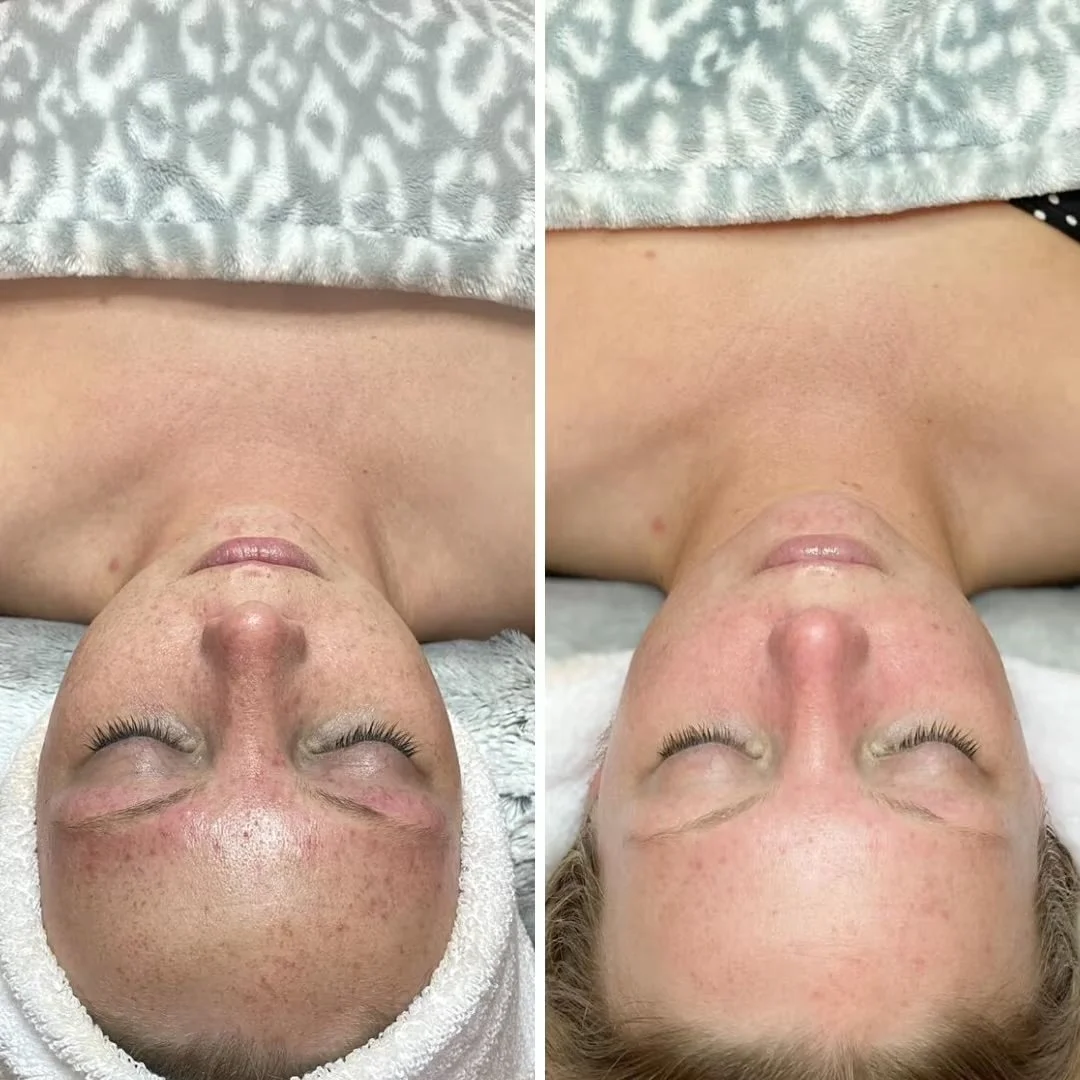sullnes skin texture.jpeg