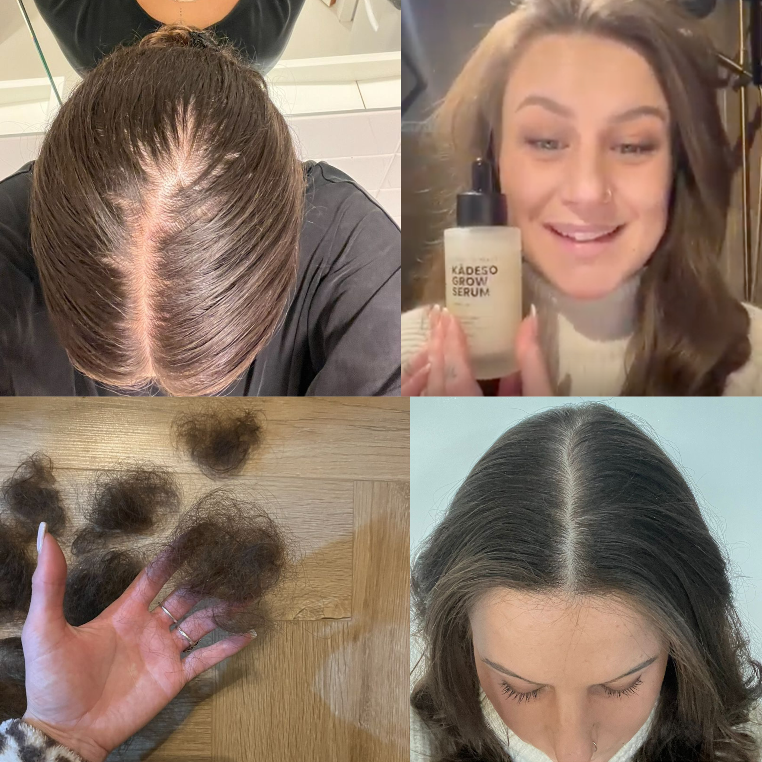 Resultaat van Roxanne — KÁDESO haargroei