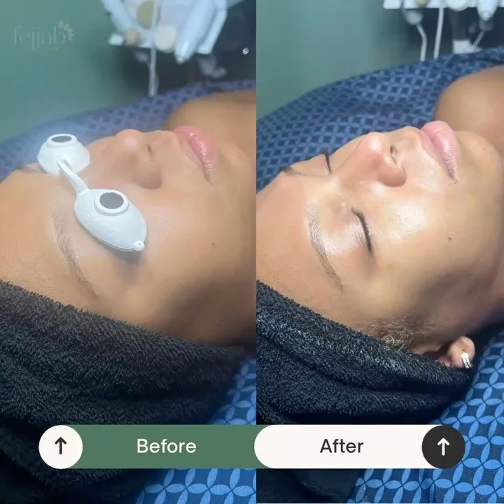 The reviews (and glows) are in… ✨🧖‍♀️
Our clients are falling in love with the Pumpkin Spice Facial — the cozy, aromatic treatment that brightens, hydrates, and leaves your skin glowing like autumn sunshine. 🍂🤎
Swipe through to s