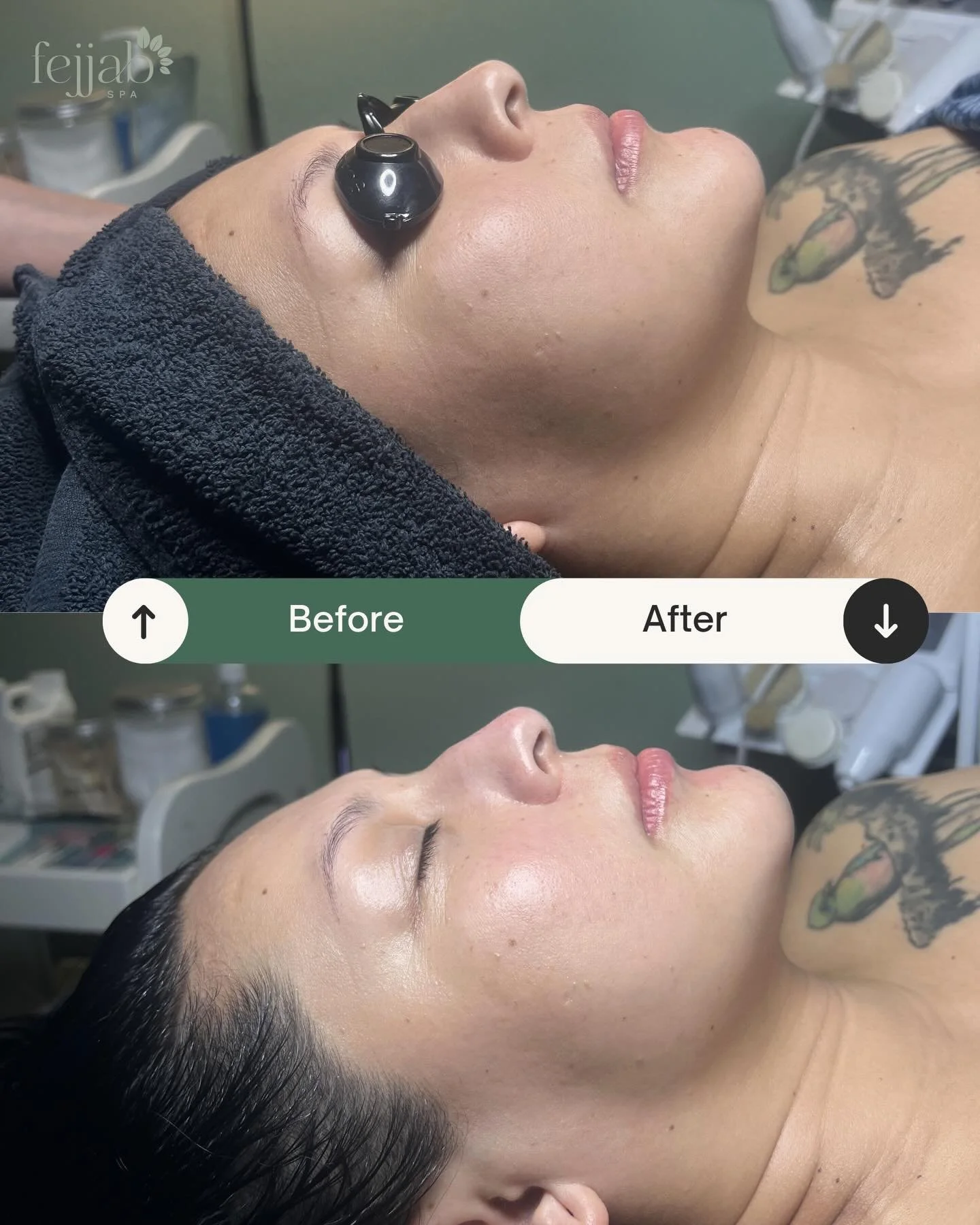 Before &rarr; After ✨

A well-deserved reset for one of our members 🤍
With consistent facials and the right skincare routine, her skin stays bright, clear, and youthful.

Tap on the link in our bio to make your appointment ✅