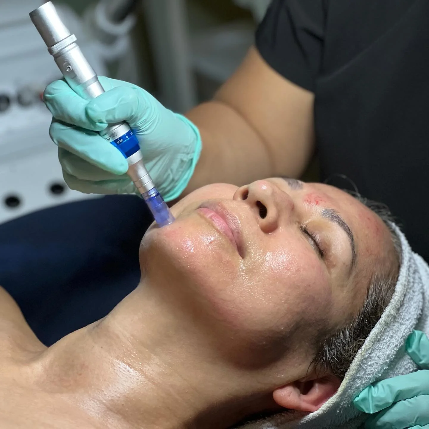 Microneedling with PDRN ✨

A regenerative treatment designed to support your skin at a deeper level&mdash;improving texture, tone, and overall glow.

If you&rsquo;re looking for long-term skin renewal, this might be the treatment for you 🤍

Tap the 