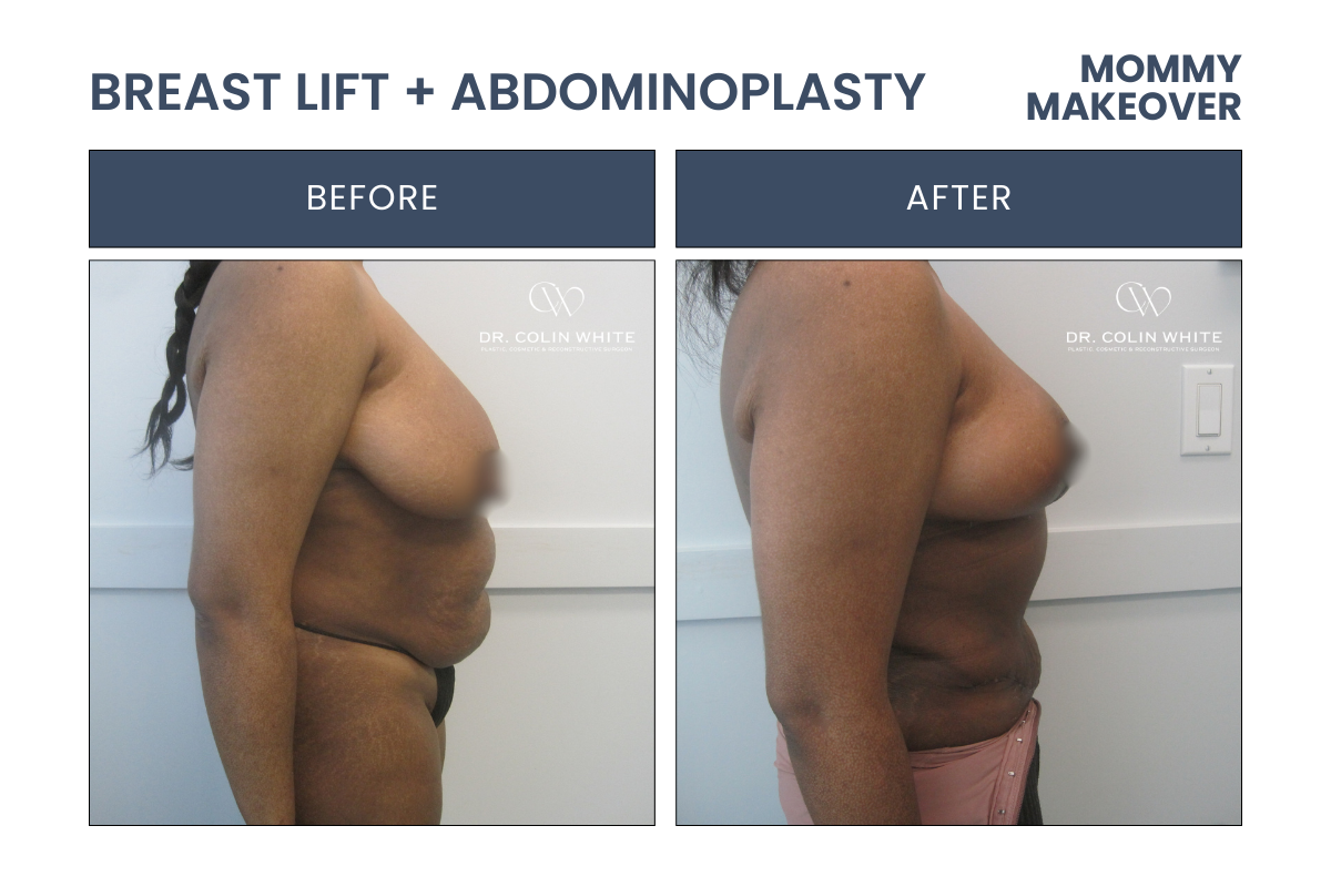 mommymakeover-2024-side-randa-m.png