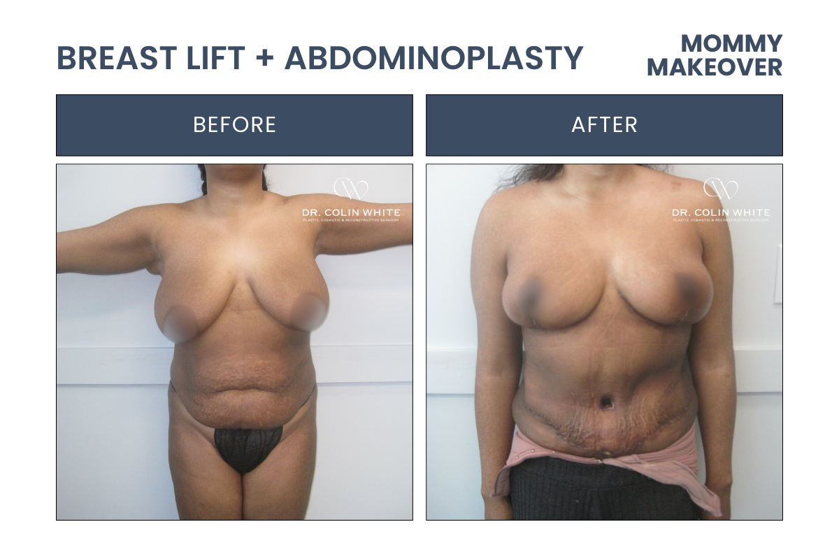 mommymakeover-2024-front-randa-m.png