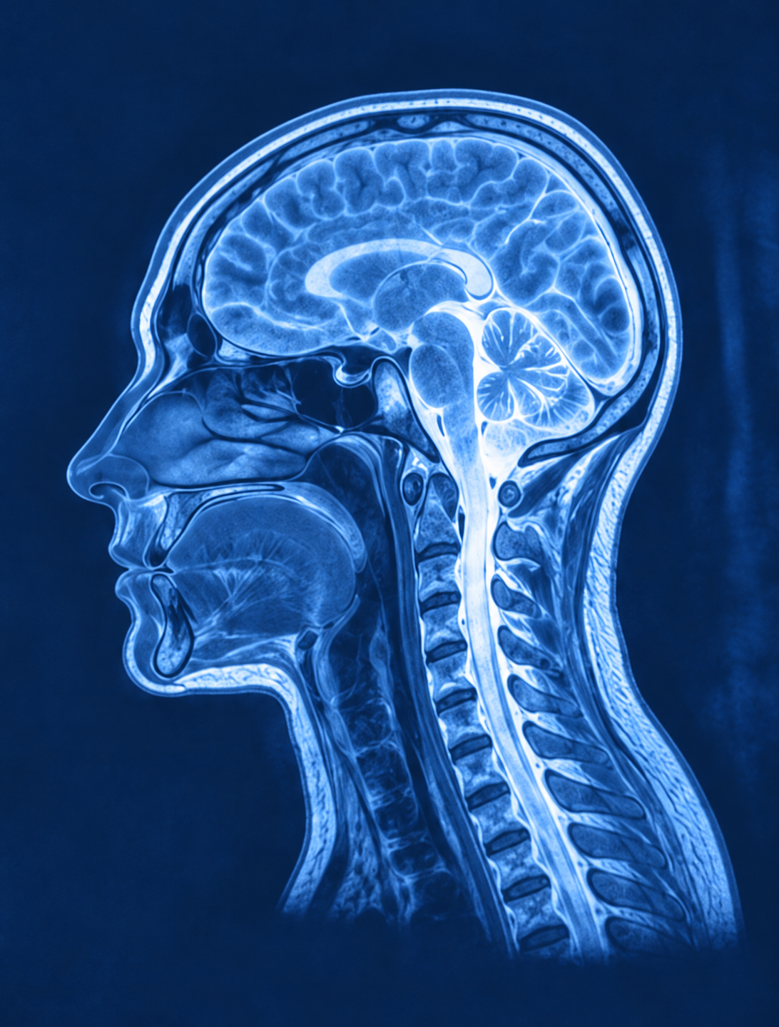 Outline drawing of a human brain in blue.