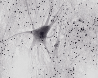 A neural cell with extensions and small dots around it.