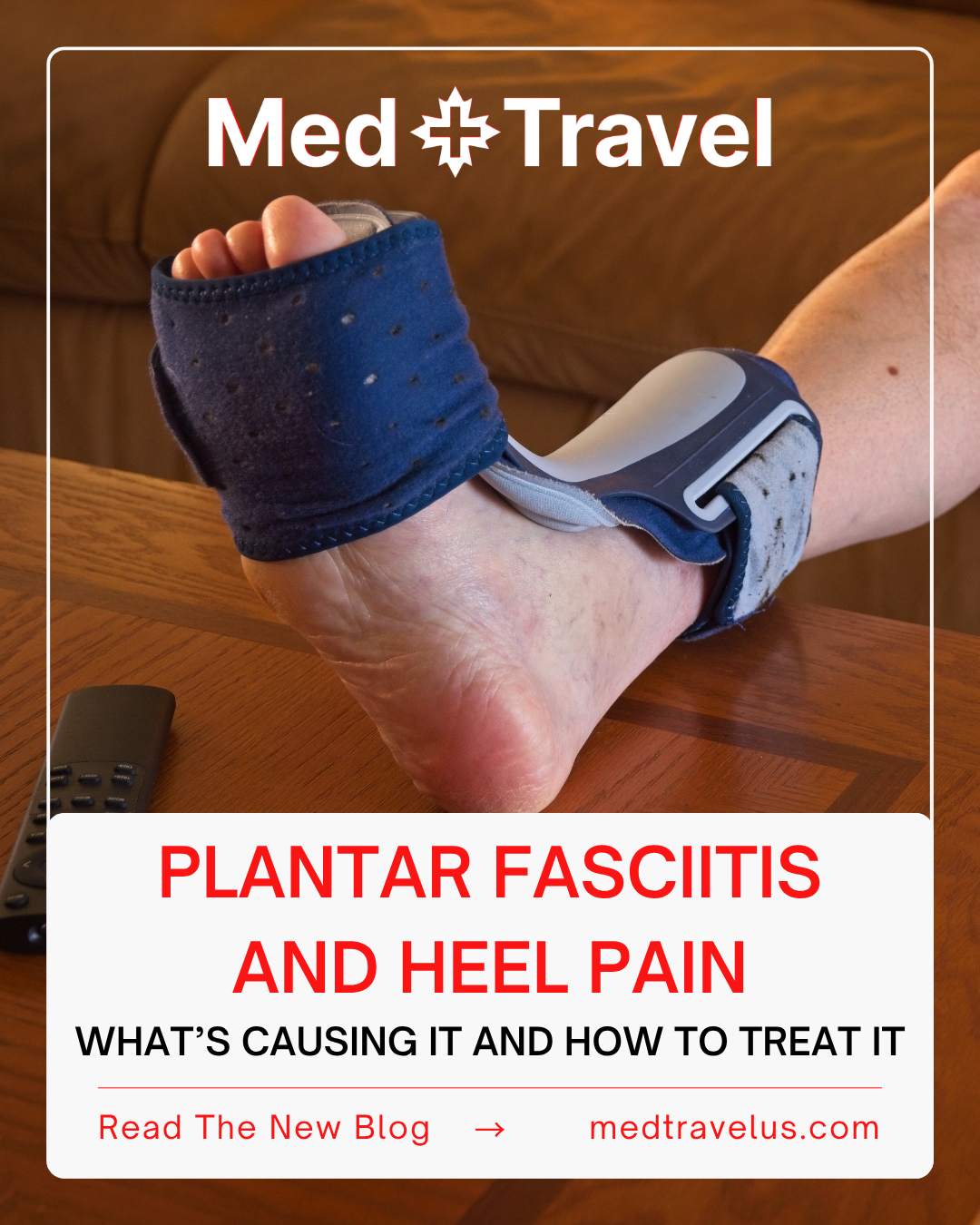 Plantar Fasciitis and Heel Pain: What’s Causing It and How to Treat It
