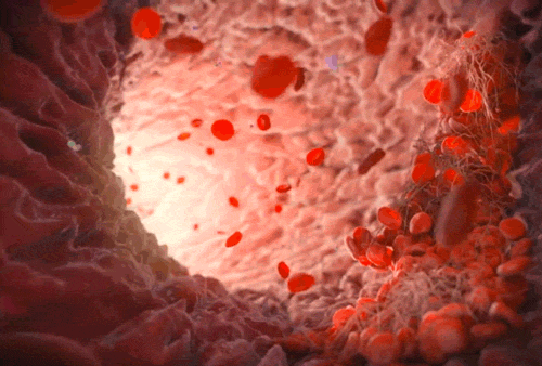 Illustration of increased blood flow as a result of acupuncture, highlighting how enhanced circulation supports healing at The Gentle Needle Guy’s clinic in Brisbane.