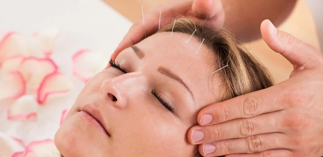Practitioner performing facial acupuncture in a calm clinic setting.
