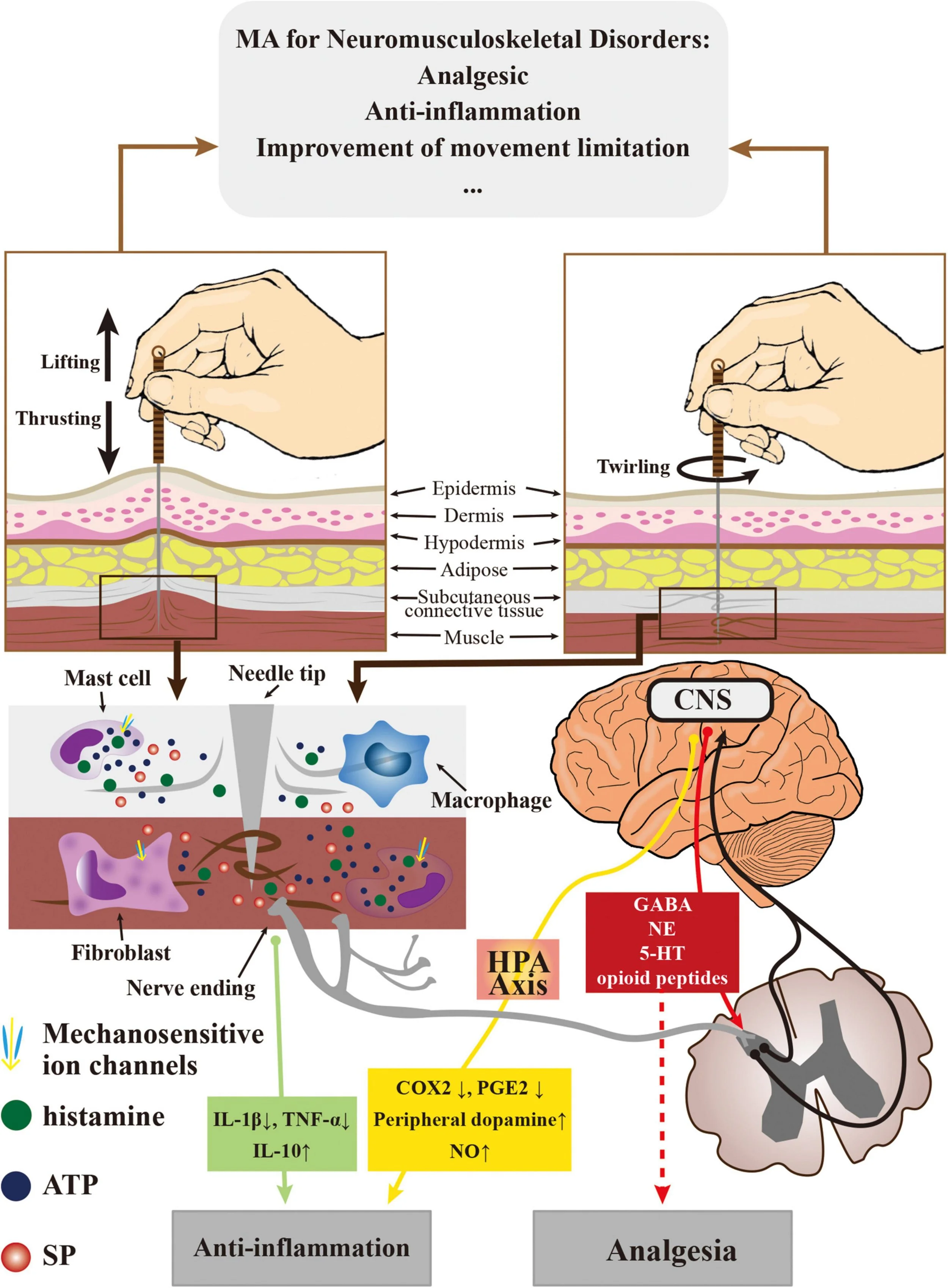 Scientific diagram showing how acupuncture modulates inflammation, pain signals, and neurotransmitter activity via connective tissue and the brain.
