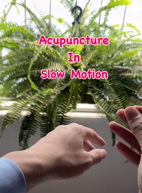 Acupuncture In Slow Motion